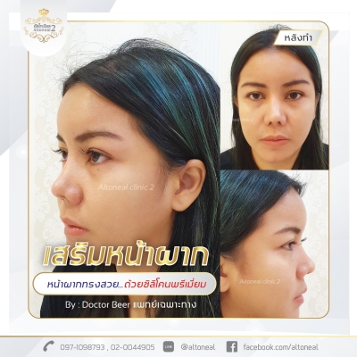 Review__ปรับสีใหม่_210511นผผผผผ