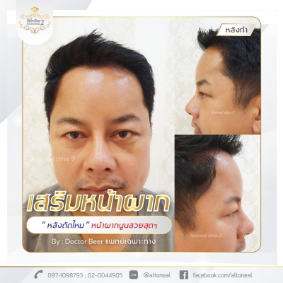 Review__ปรับสีใหม่_210512น