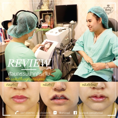 Review_๑๙๐๕๒๒_0293