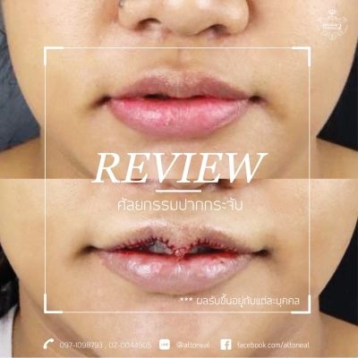 Review_190405_0119