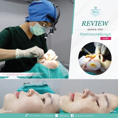 Review_190711_0541