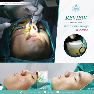 Review_190711_0546