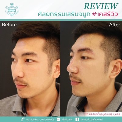 Review_190719_0578