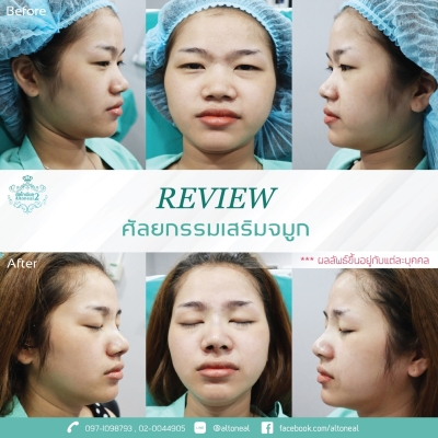 Review_190719_0580